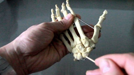 ابتكار نموذج لأصبع سادس في يد الإنسان