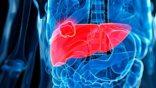 ريجورافينيب أول عقار ناجح لعلاج سرطان الكبد المتقدم