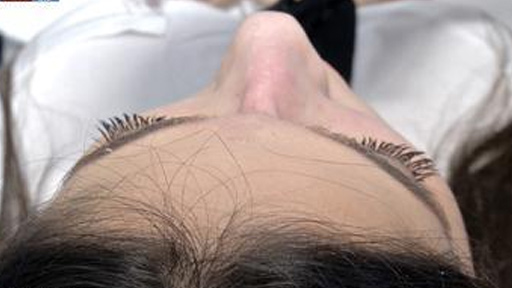 "معضلة الأنف".. حلم الكثيرين بات متاحا