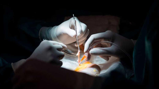 تخليق أعضاء خنازير أكثر أمانا لزرعها في أجساد بشرية