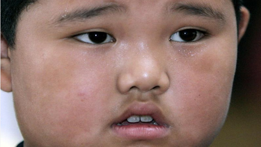 الأطباء ينصحون: لا تعيبوا على الأطفال البدانة