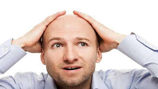 الأطباء يحذّرون الصُّلع!