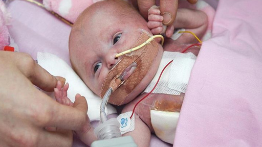 إنقاذ "إعجازي" لرضيعة قلبها خارج جسدها