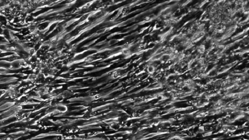 زراعة عضلات من خلايا جلدية لأول مرة في العالم