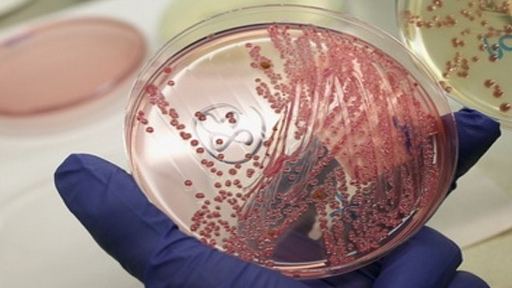 منظمة الصحة العالمية: تفشي بكتريا الليستريا في جنوب أفريقيا هو الأكبر