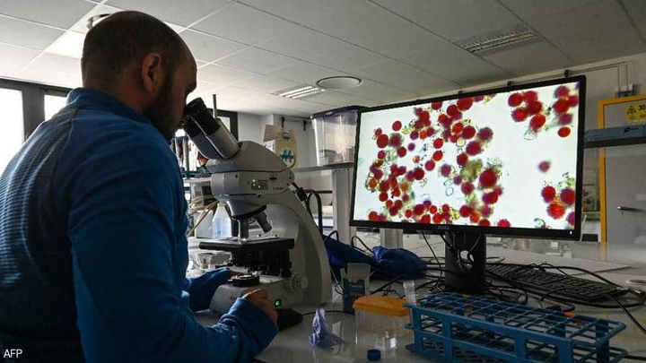 كيف تكتشف ارتفاع الكوليسترول؟.. السر في "العين"